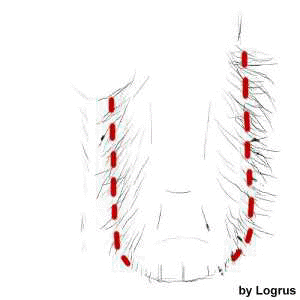 grfrontlegg3